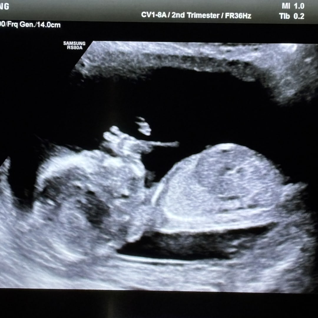 Photo shared by Melissa and Jack for their Babylist baby registry.