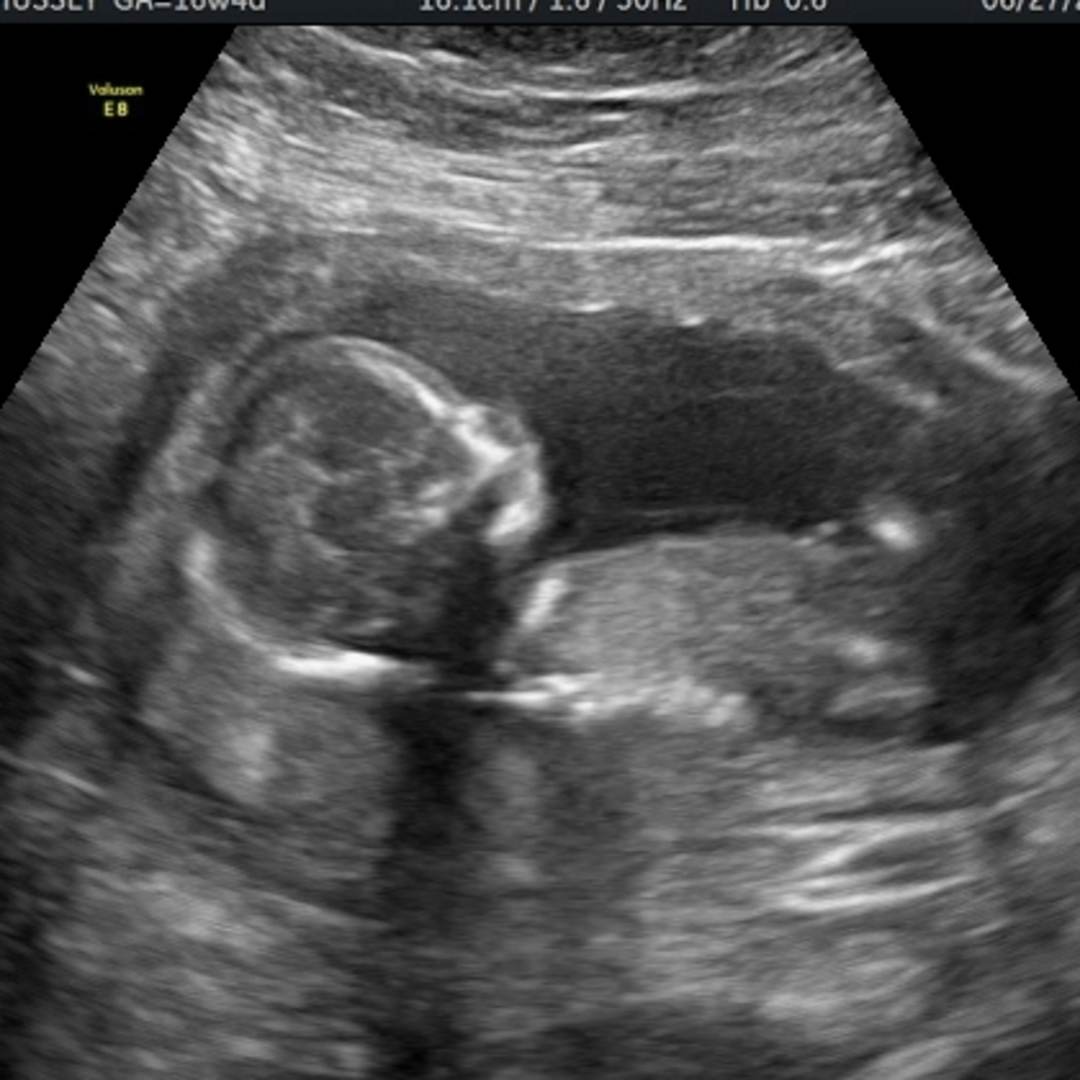 Photo shared by Harleigh for their Babylist baby registry.