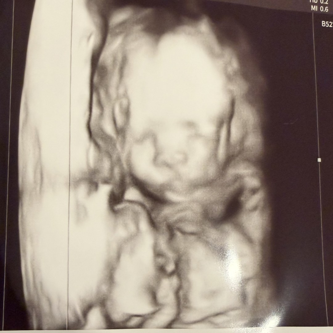 Photo shared by Carley for their Babylist baby registry.