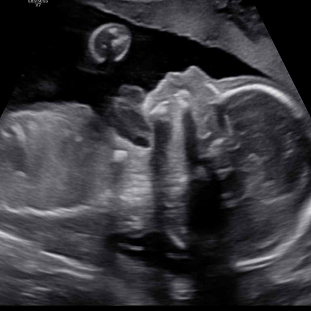 Photo shared by Elly for their Babylist baby registry.