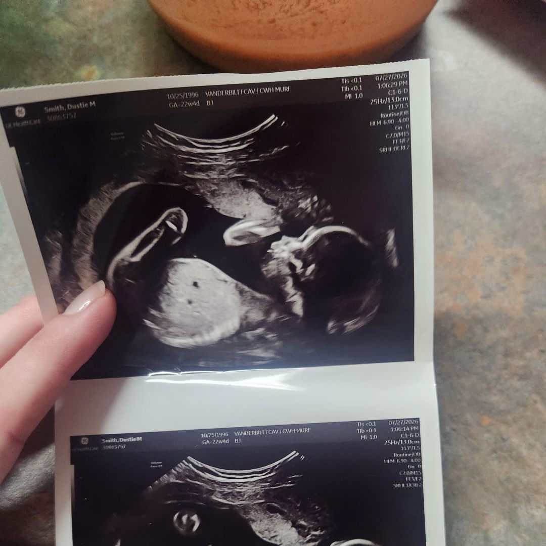 Photo shared by Dustie for their Babylist baby registry.