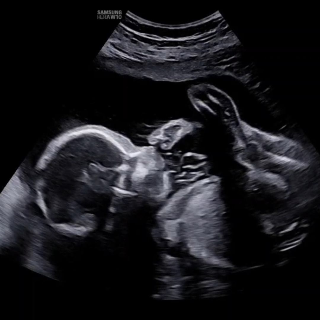 Photo shared by Amber for their Babylist baby registry.