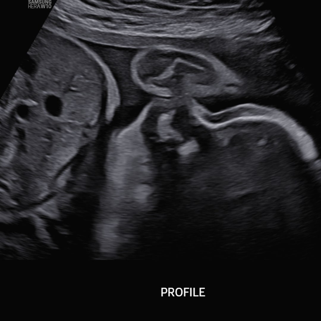Photo shared by Jenna for their Babylist baby registry.
