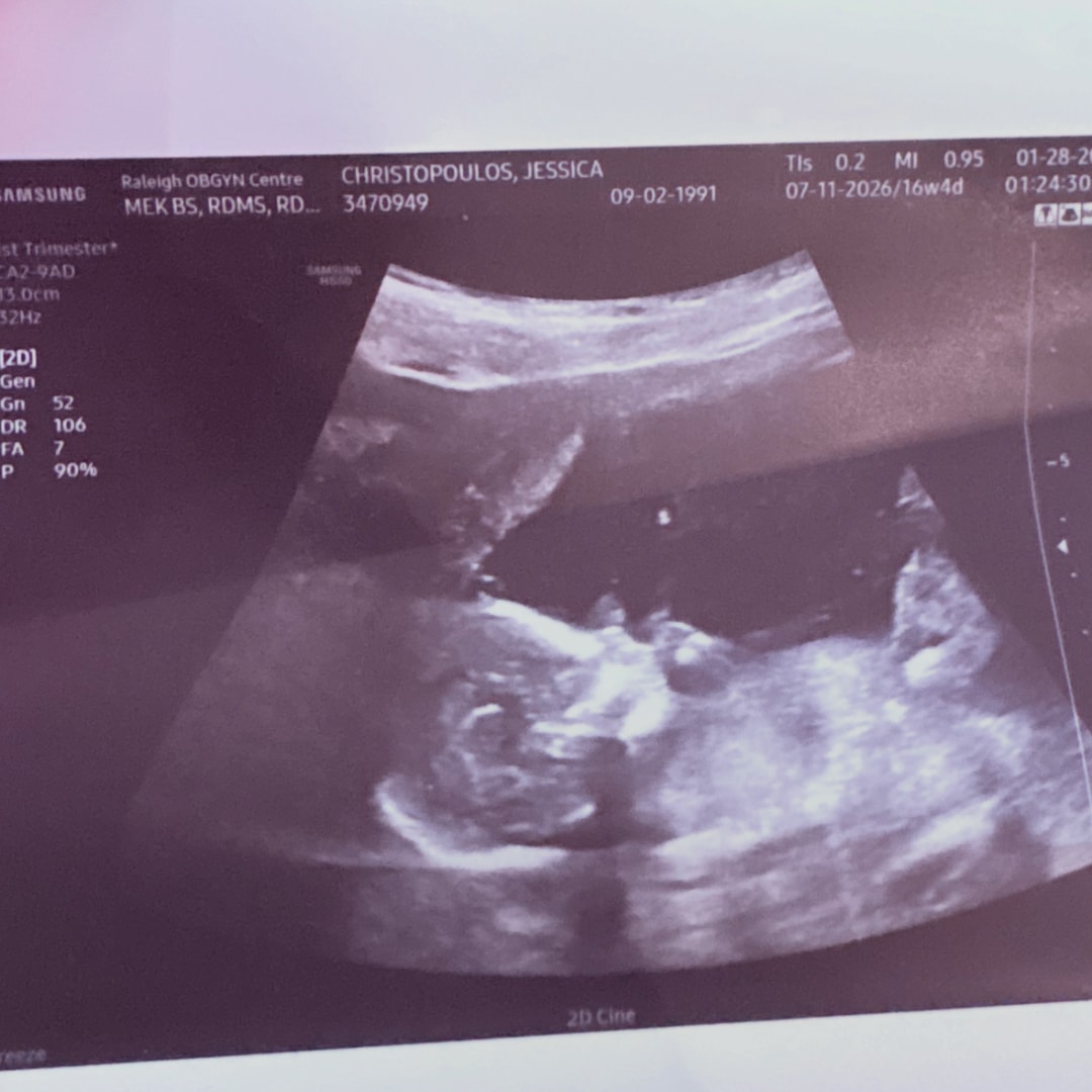 Photo shared by Jessica for their Babylist baby registry.