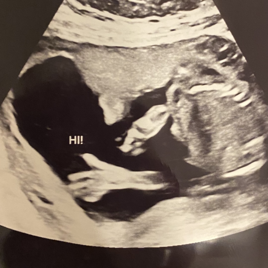 Photo shared by Rebecca for their Babylist baby registry.