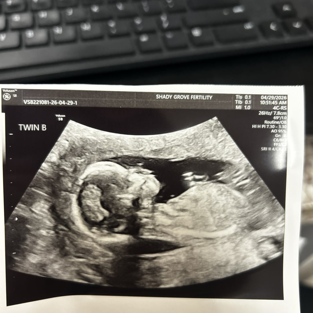 Photo shared by Hannah for their Babylist baby registry.