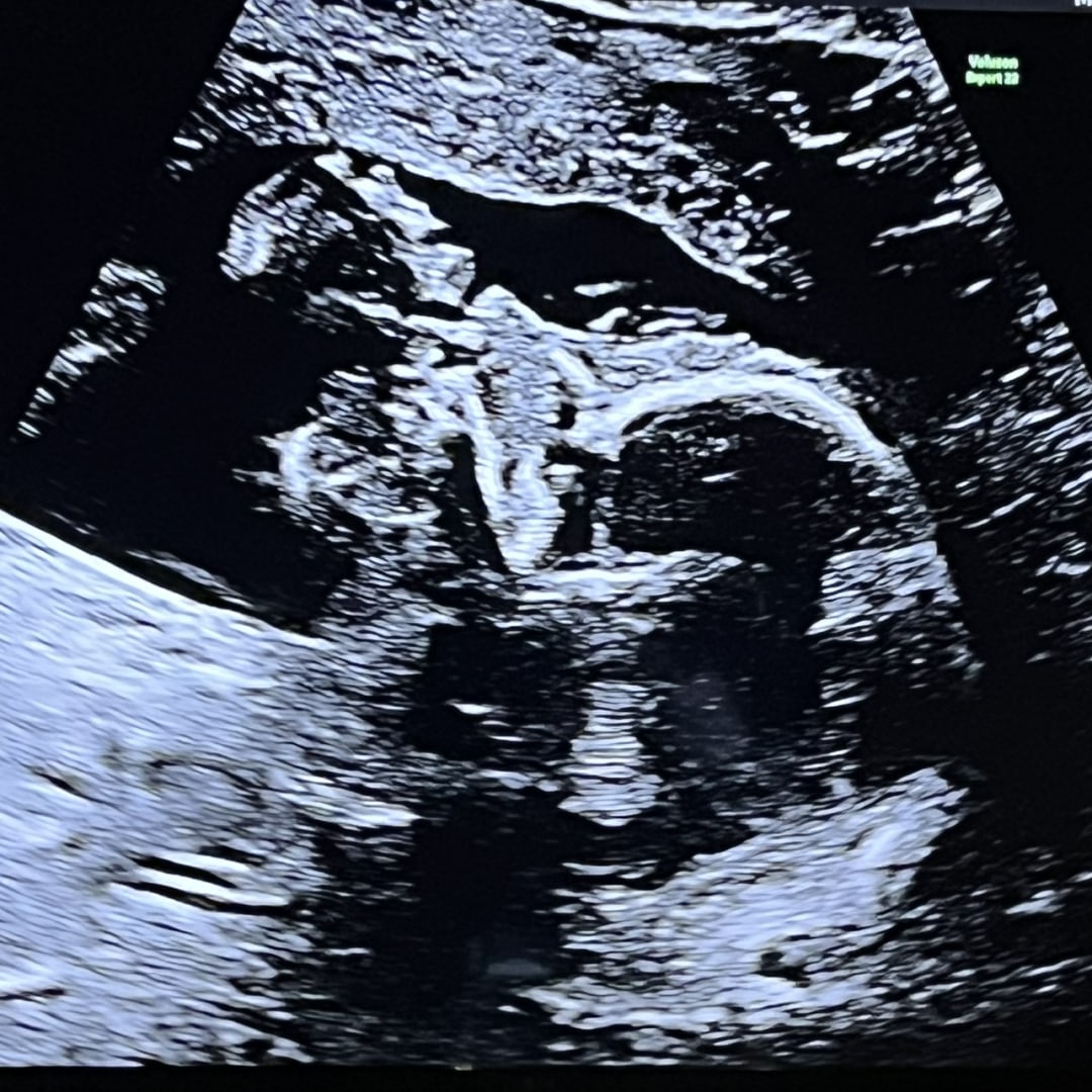 Photo shared by Stephanie for their Babylist baby registry.