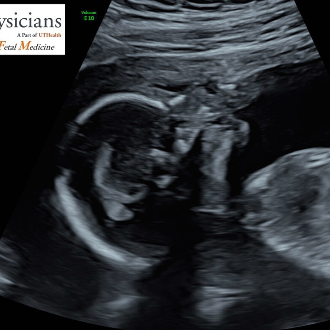 Photo shared by Ansliee for their Babylist baby registry.