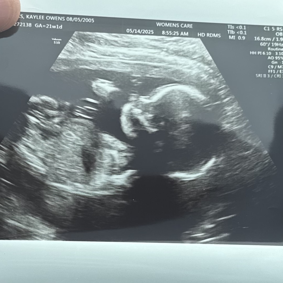 Photo shared by Kaylee for their Babylist baby registry.