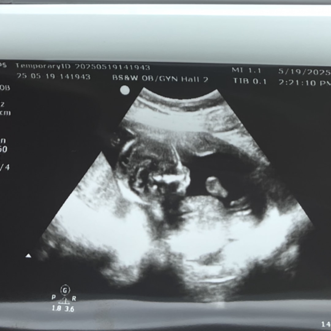 Photo shared by Bethany for their Babylist baby registry.