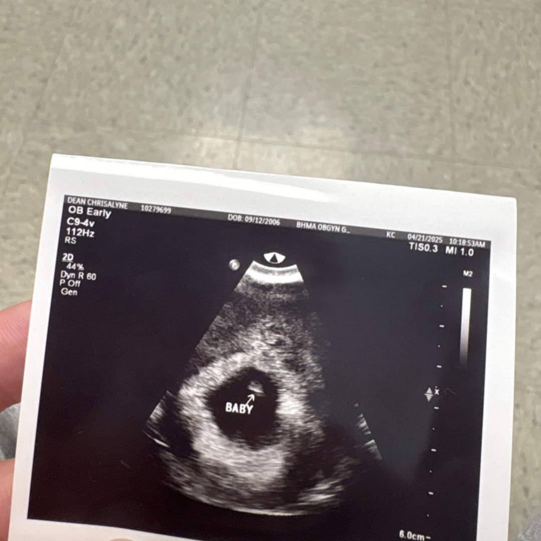 Photo shared by Chrisalyne for their Babylist baby registry.