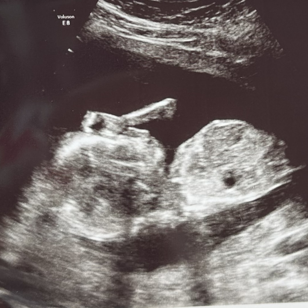 Photo shared by Brooke for their Babylist baby registry.