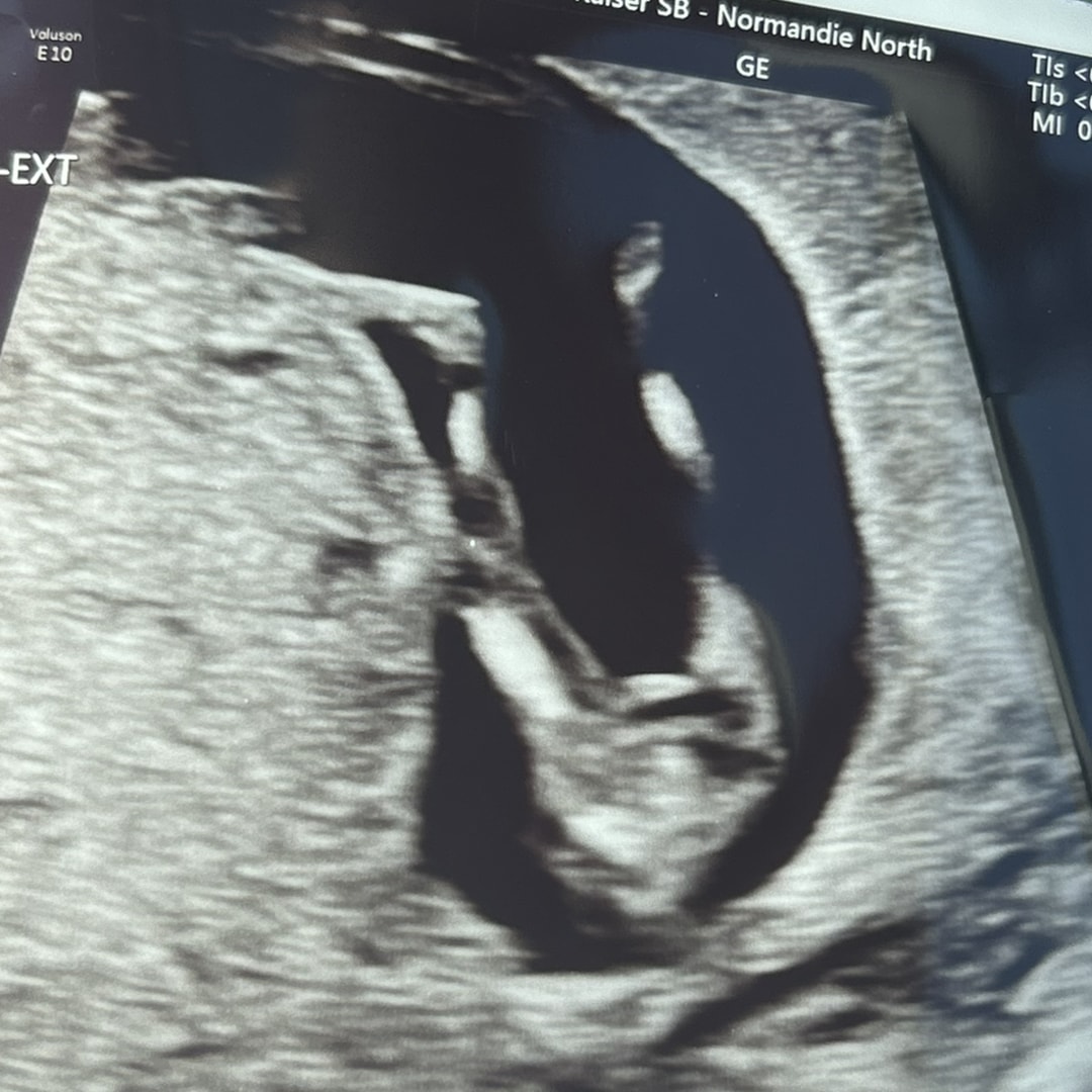 Photo shared by Jill for their Babylist baby registry.