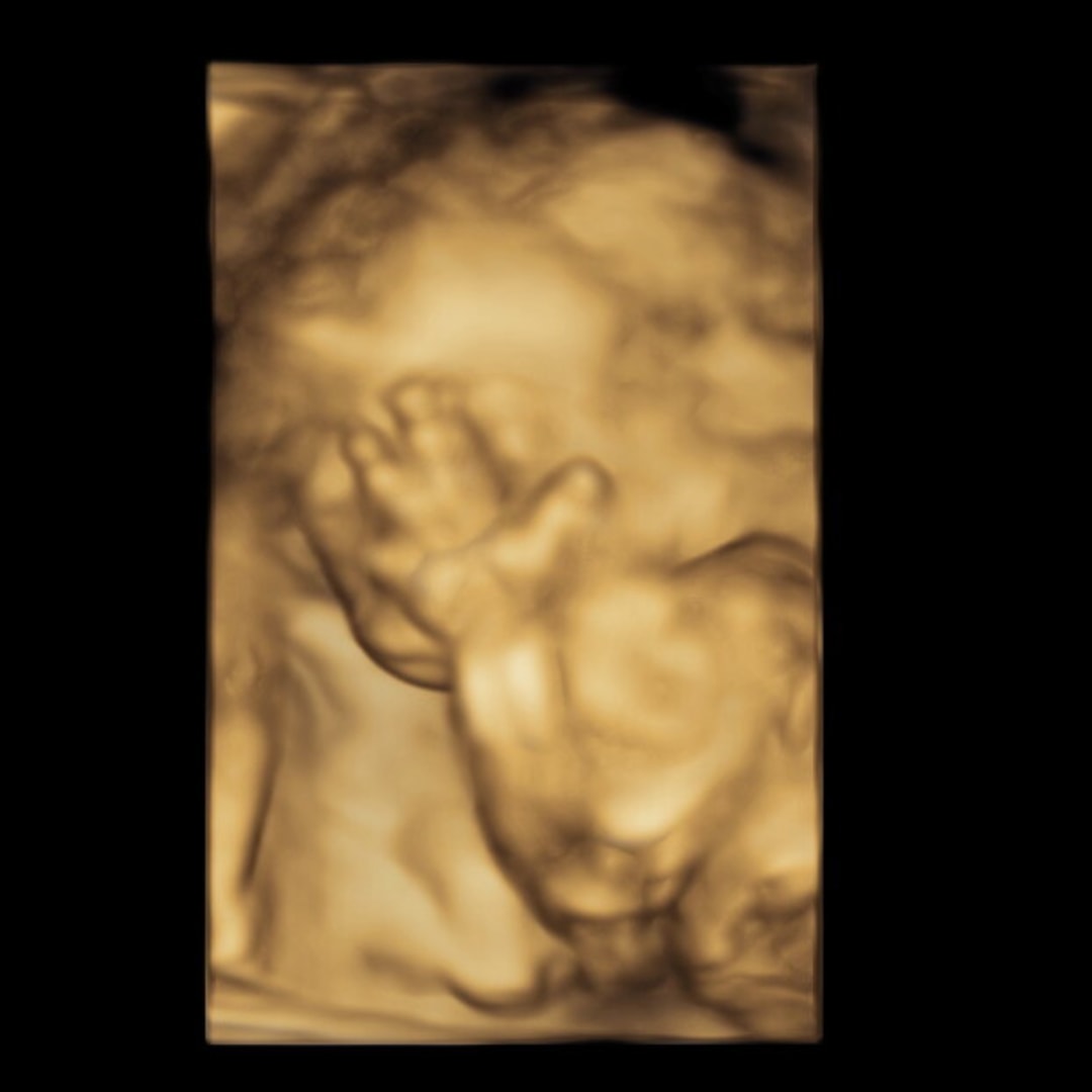 Photo shared by Josie for their Babylist baby registry.