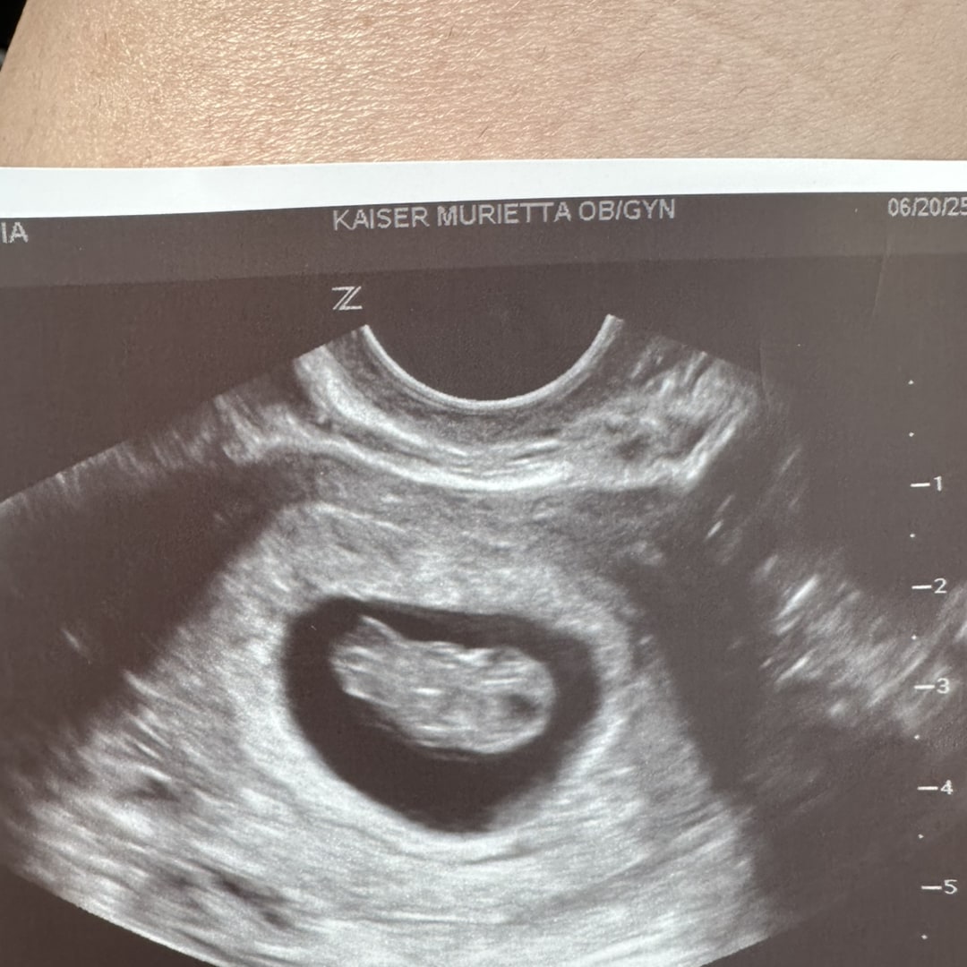 Photo shared by Cynthia for their Babylist baby registry.