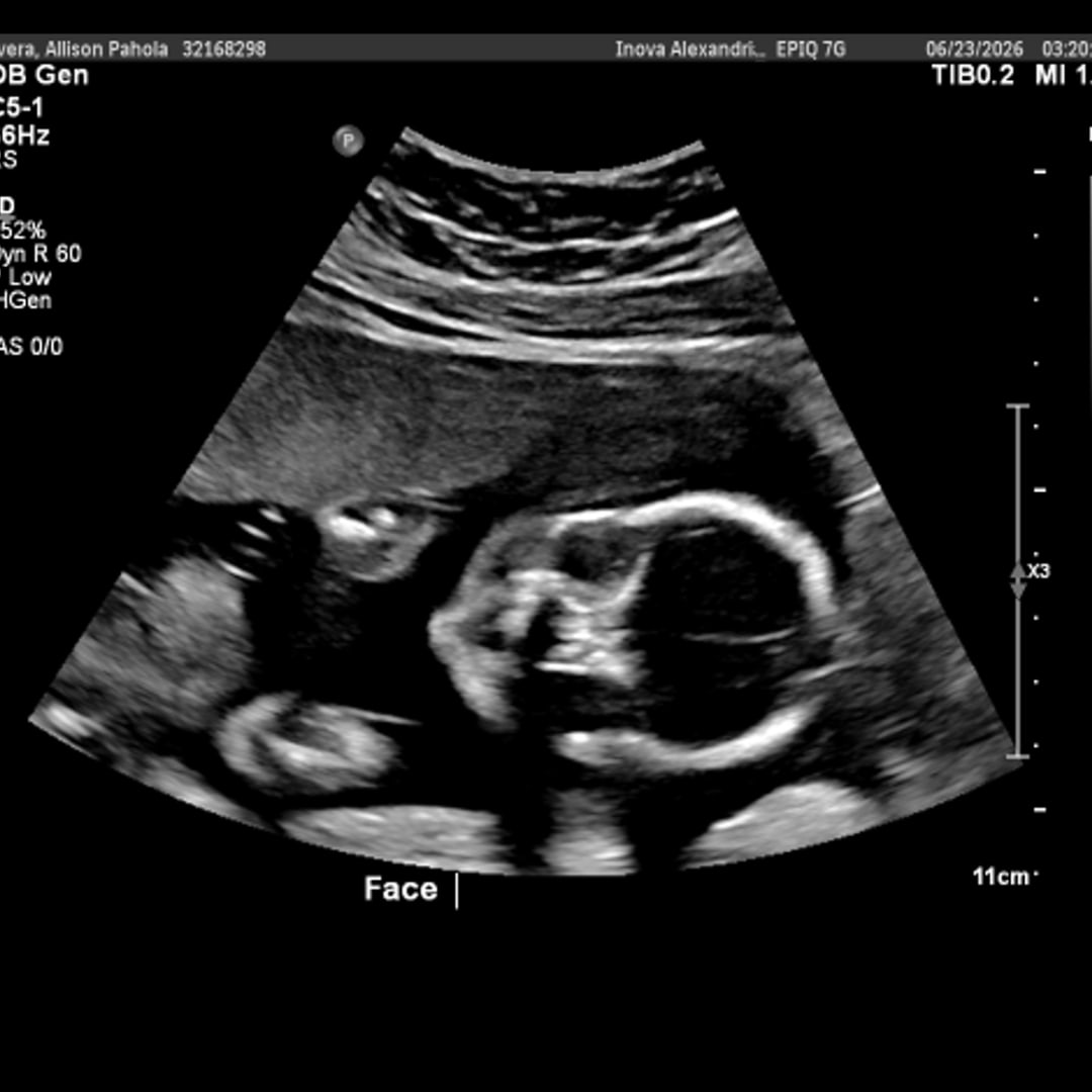 Photo shared by Allison for their Babylist baby registry.