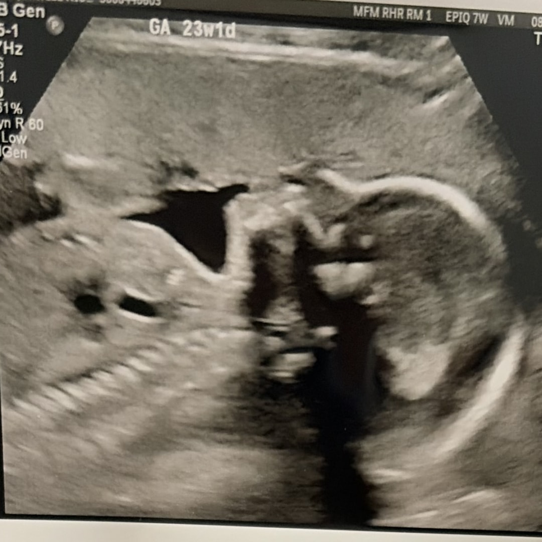 Photo shared by Haylee for their Babylist baby registry.