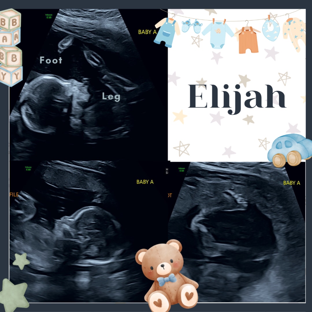 Photo shared by Shantel for their Babylist baby registry.