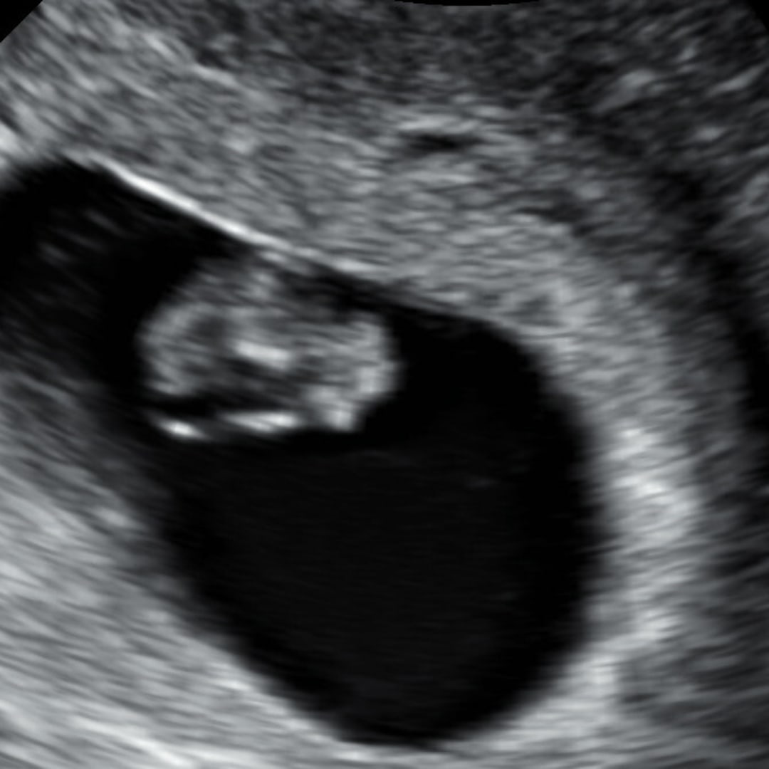 Photo shared by Bailey for their Babylist baby registry.