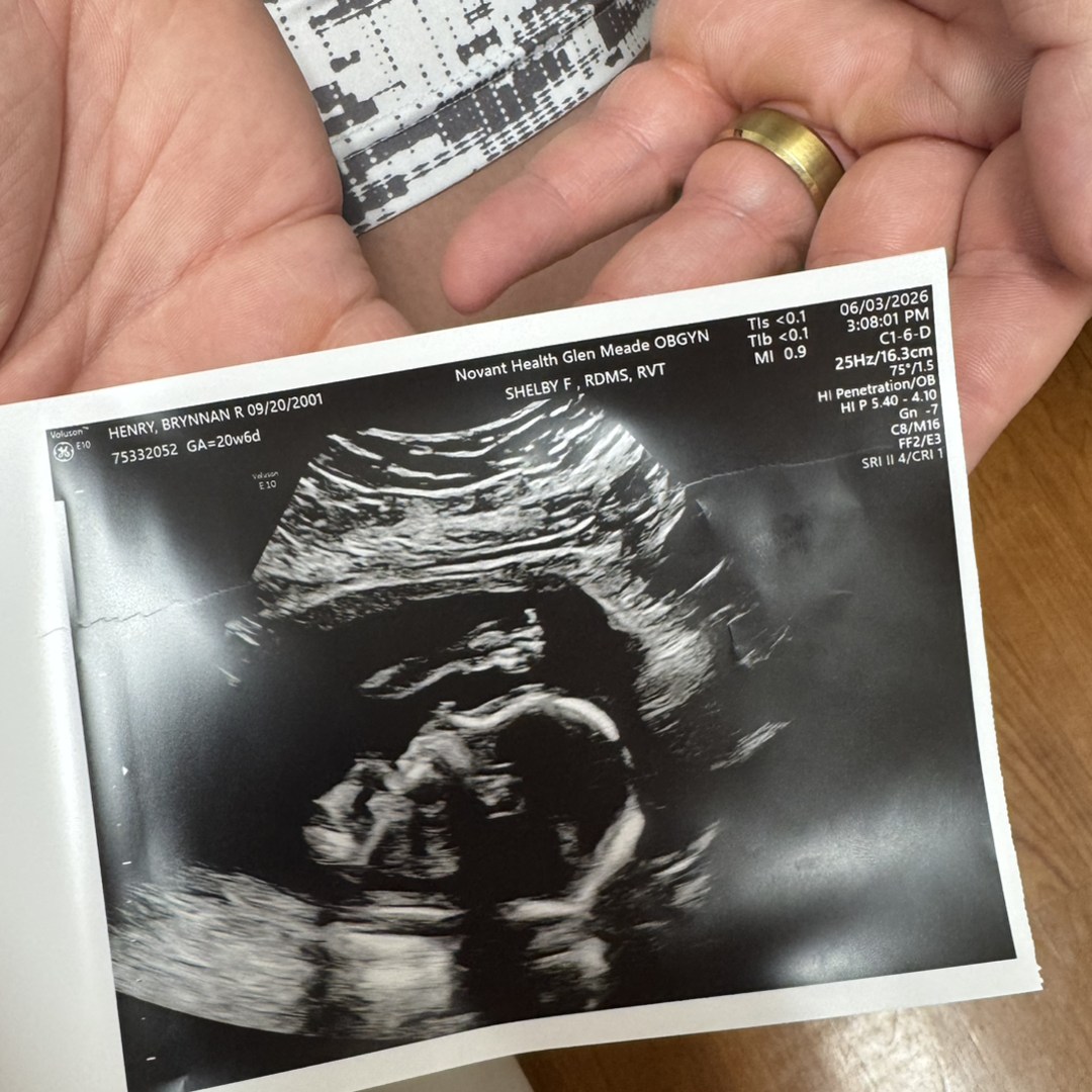 Photo shared by Brynnan for their Babylist baby registry.