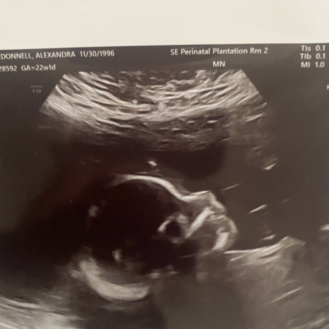 Photo shared by Alexandra for their Babylist baby registry.