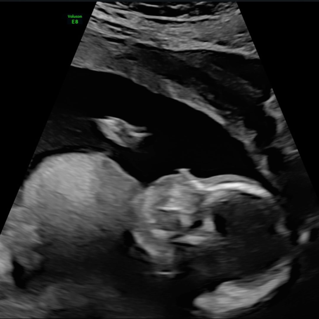 Photo shared by Chyna for their Babylist baby registry.