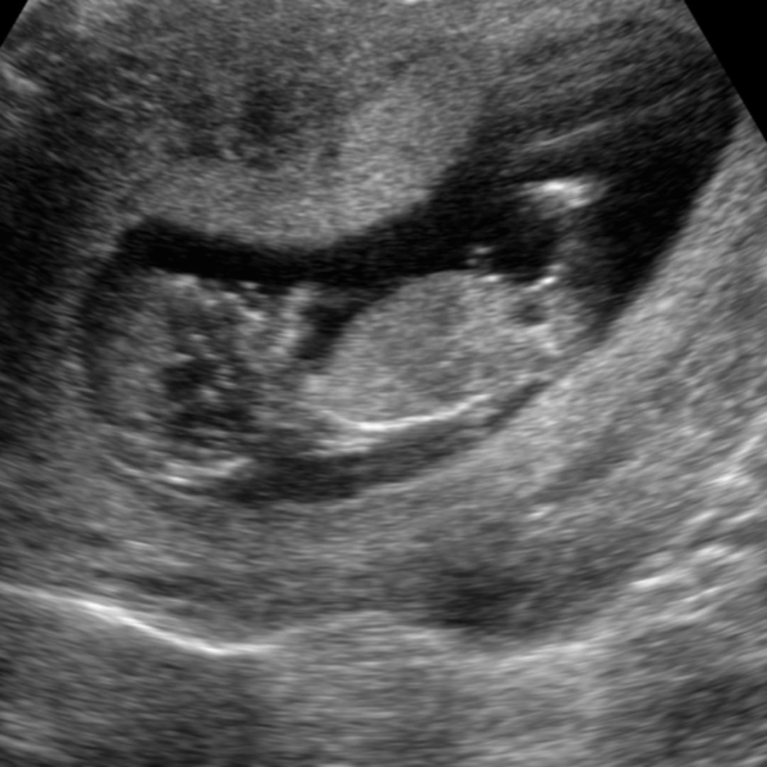 Photo shared by Melanie for their Babylist baby registry.