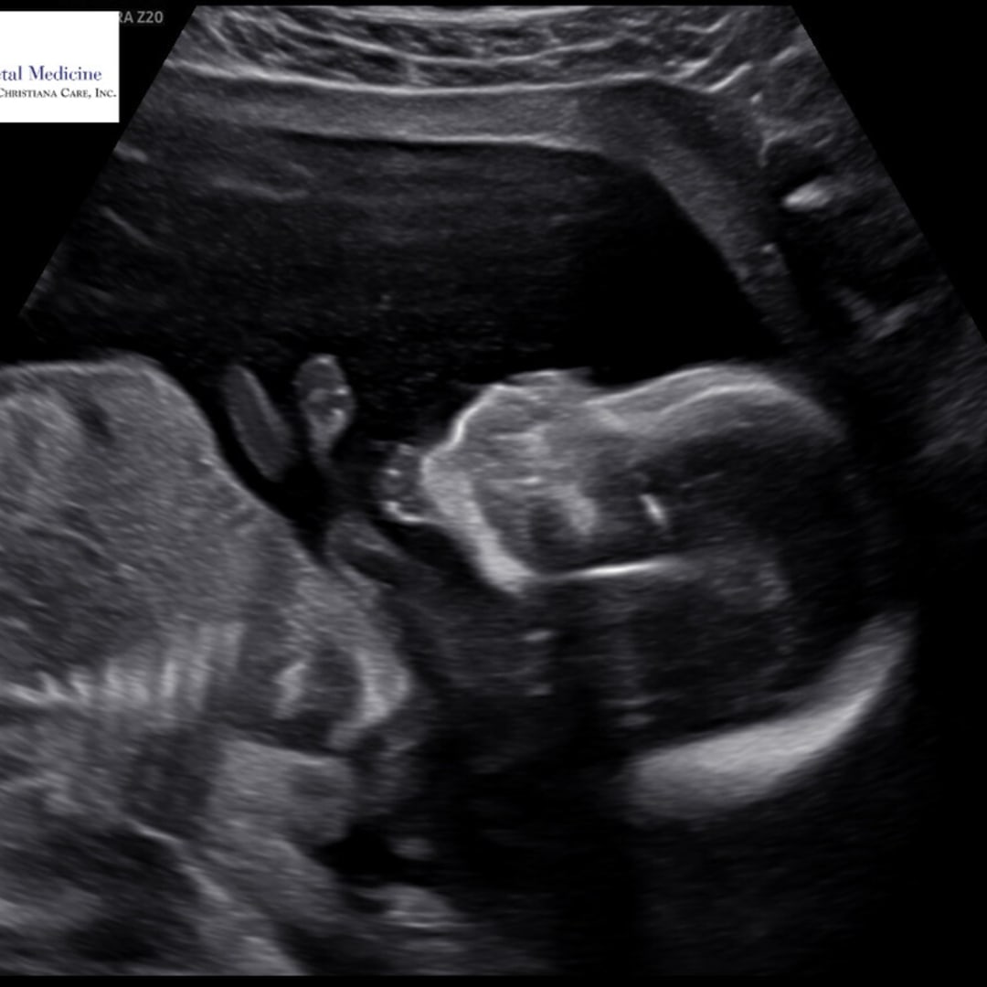 Photo shared by Mackenzie for their Babylist baby registry.