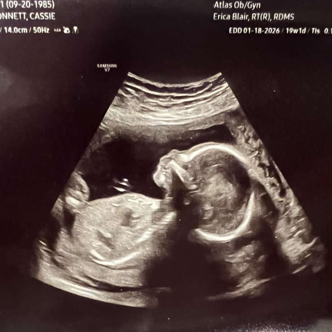 Photo shared by Cassandra for their Babylist baby registry.