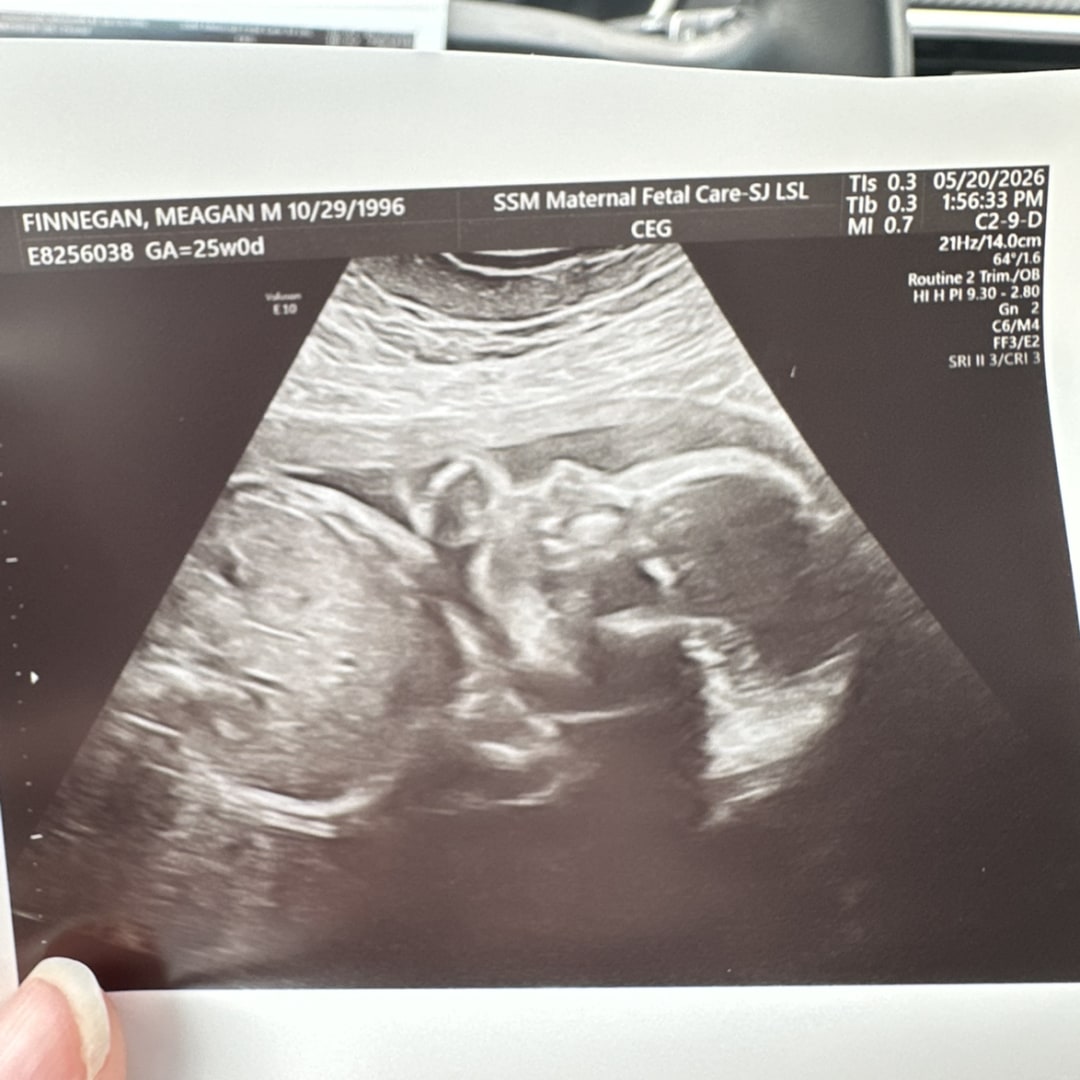 Photo shared by Meagan for their Babylist baby registry.