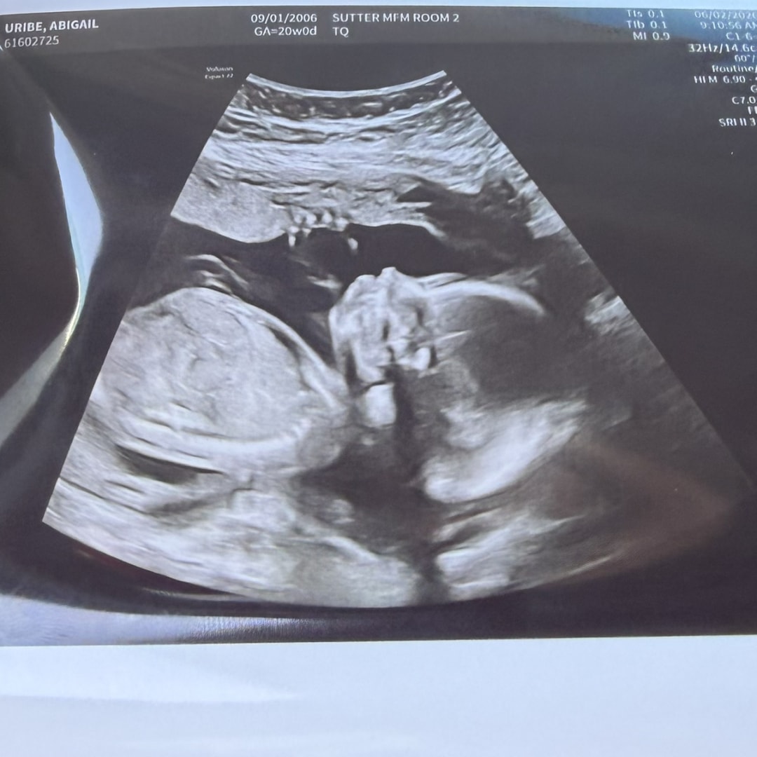 Photo shared by Abigail for their Babylist baby registry.