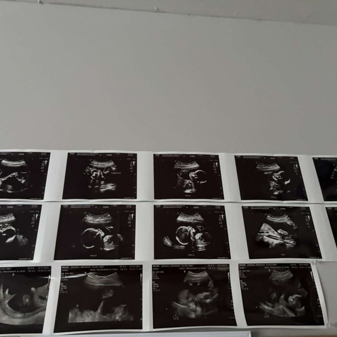 Photo shared by Breanna for their Babylist baby registry.