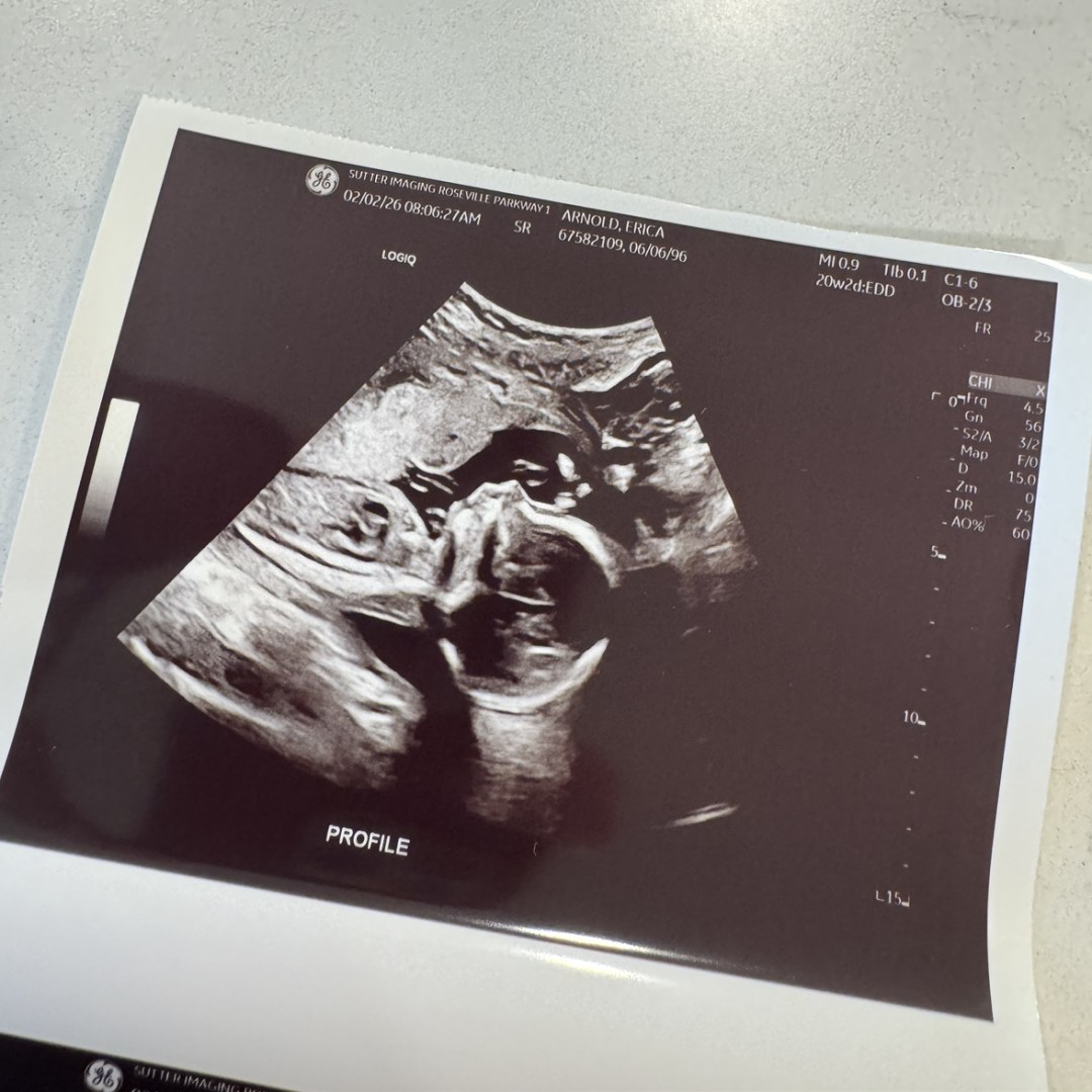 Photo shared by Erica for their Babylist baby registry.