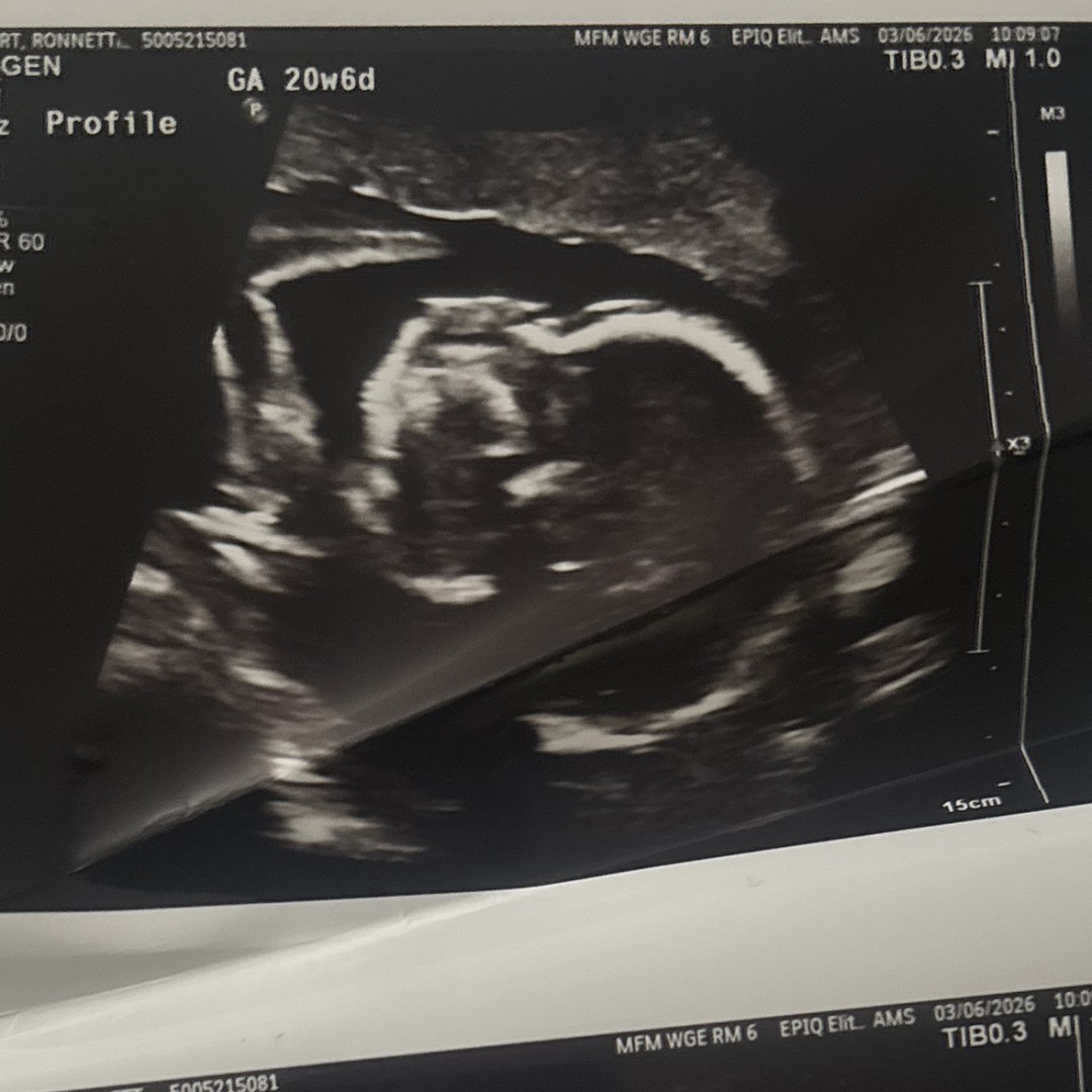 Photo shared by Ronnettah for their Babylist baby registry.