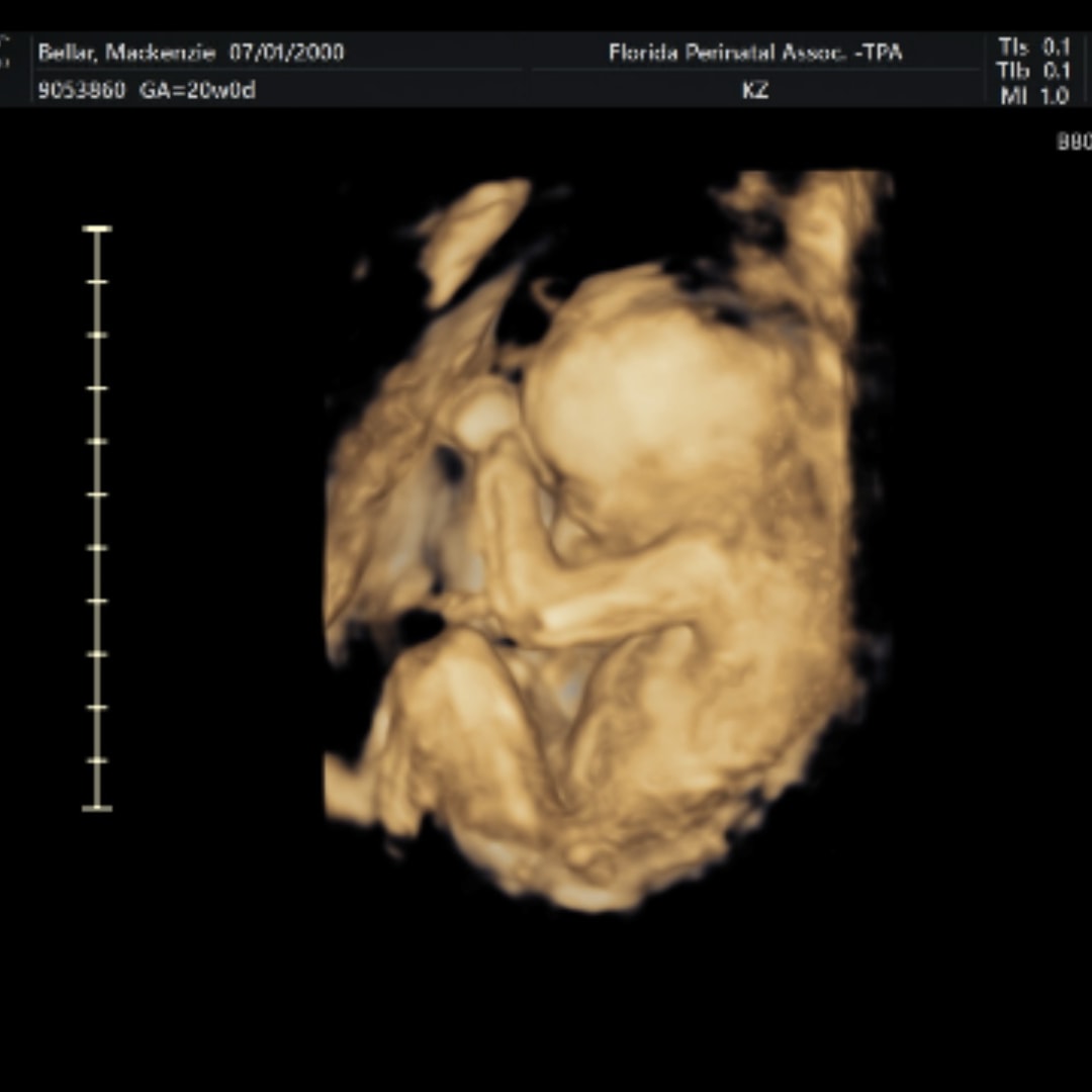 Photo shared by Mackenzie for their Babylist baby registry.