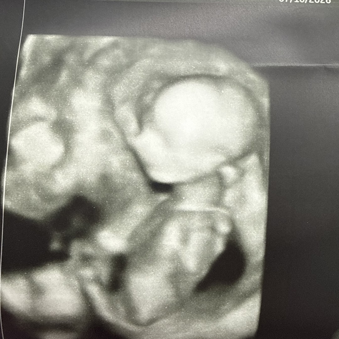 Photo shared by Jenifer for their Babylist baby registry.