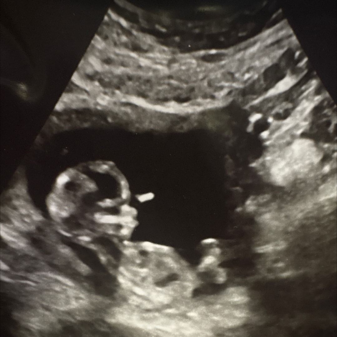 Photo shared by Chasity for their Babylist baby registry.