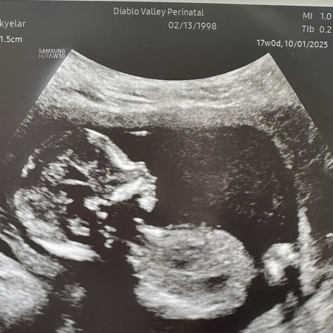 Photo shared by Skyelar for their Babylist baby registry.