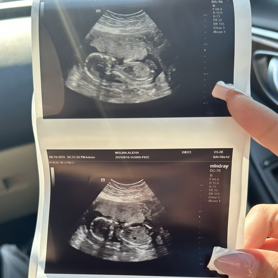 Photo shared by Alexia for their Babylist baby registry.