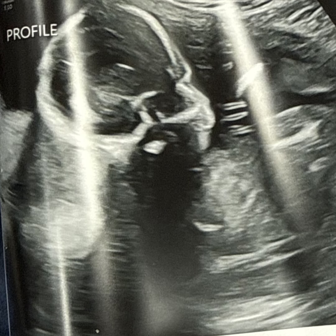 Photo shared by Emlee for their Babylist baby registry.