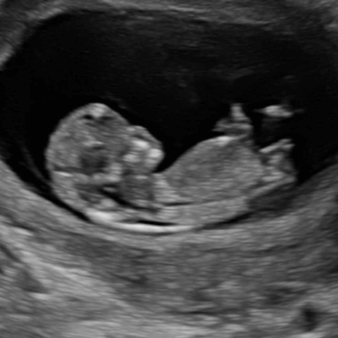 Photo shared by Camryn for their Babylist baby registry.