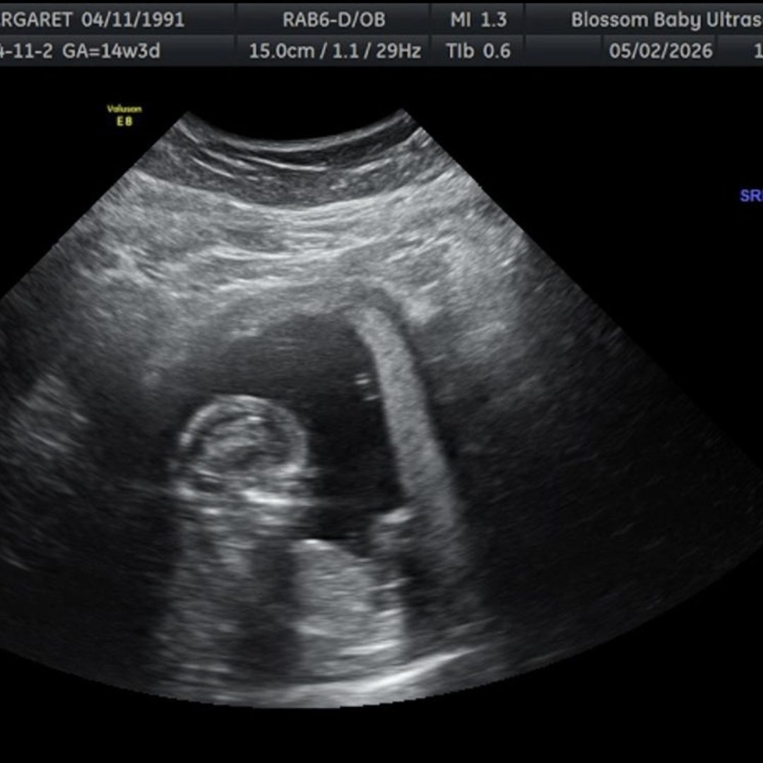 Photo shared by Margaret for their Babylist baby registry.