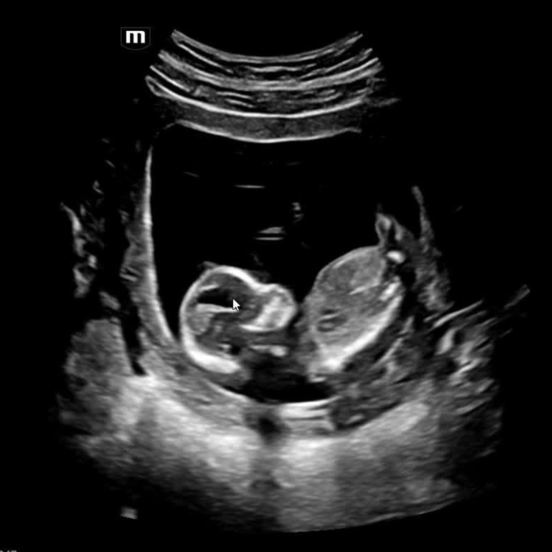 Photo shared by Samantha for their Babylist baby registry.