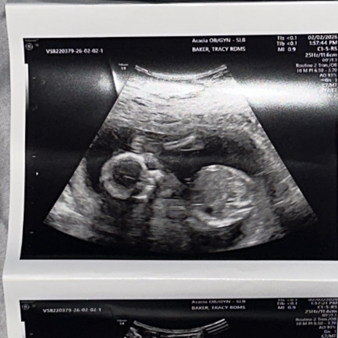 Photo shared by Hailey for their Babylist baby registry.