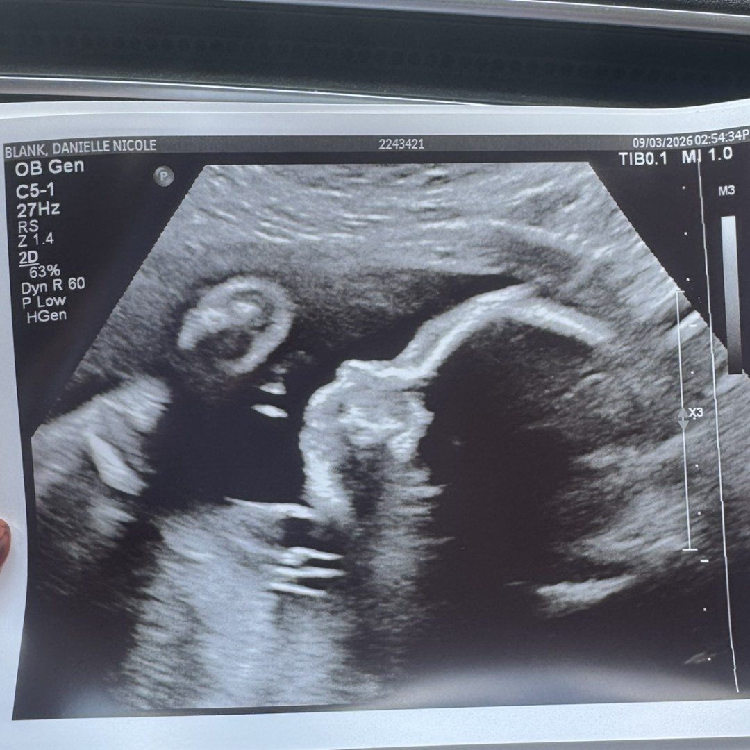 Photo shared by Danielle for their Babylist baby registry.
