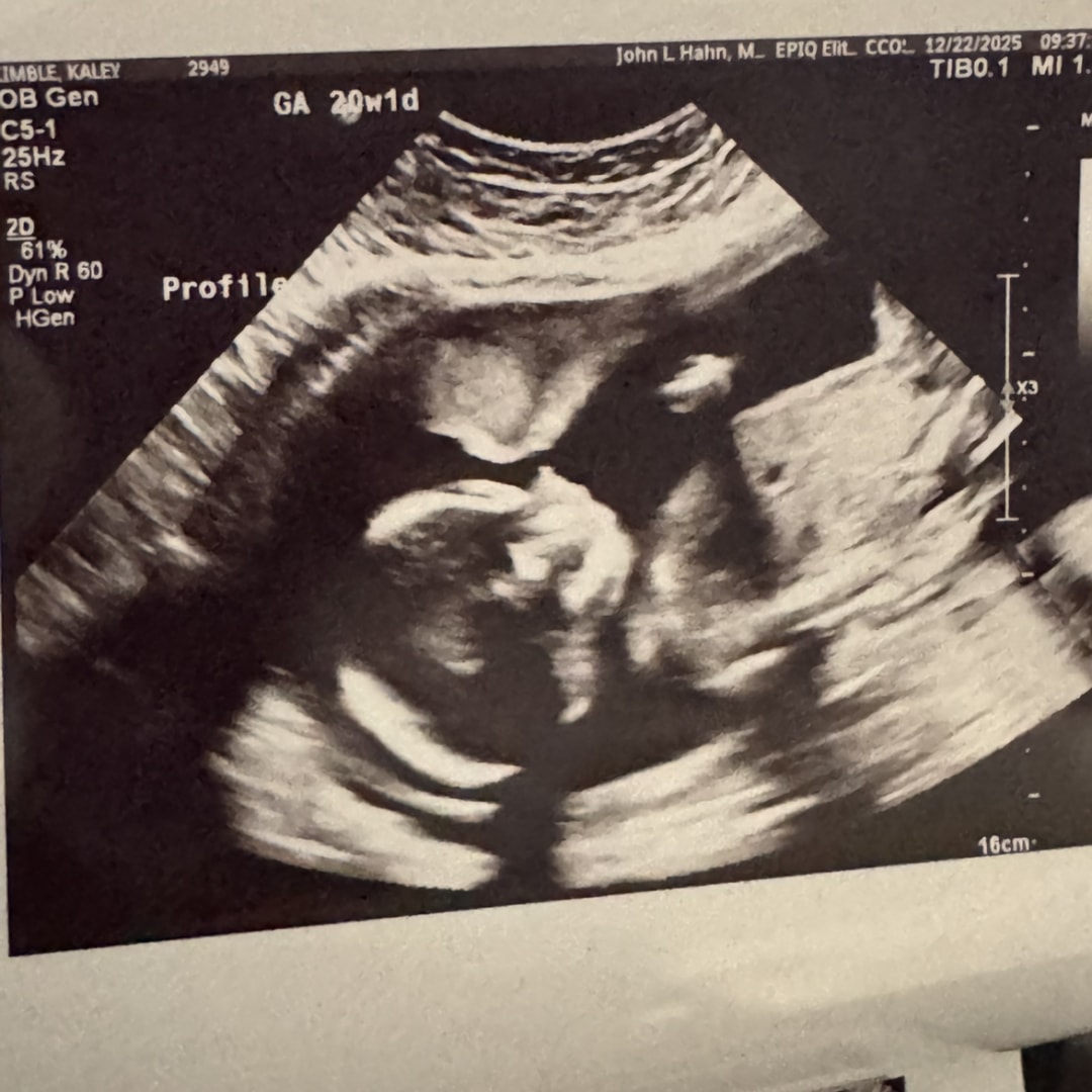 Photo shared by Kaley for their Babylist baby registry.