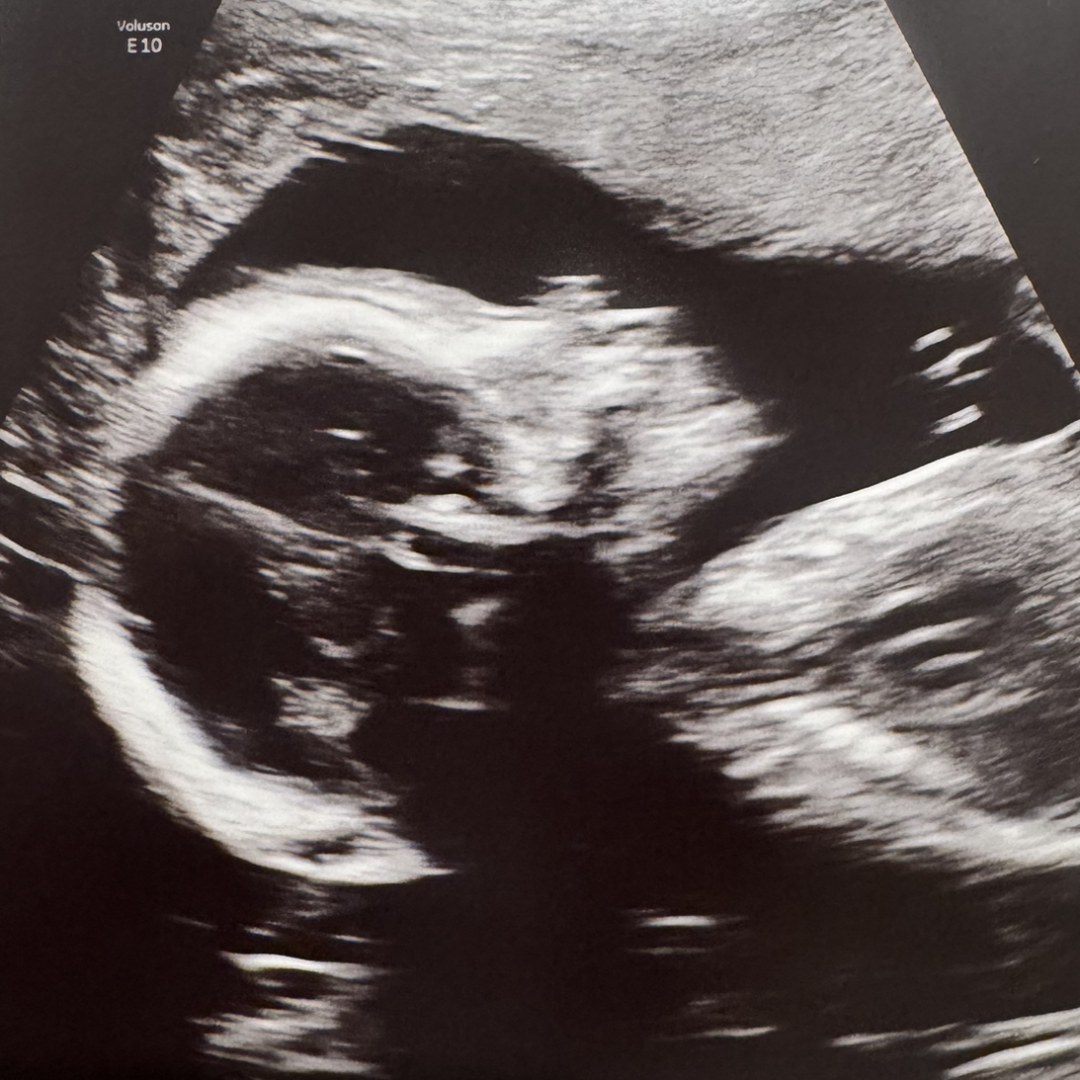 Photo shared by Marina for their Babylist baby registry.