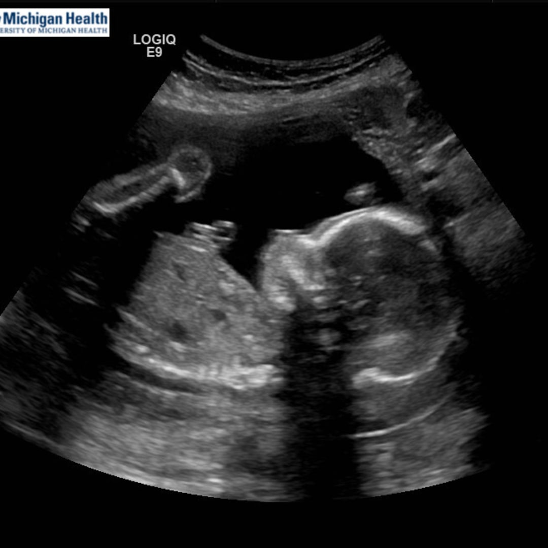 Photo shared by Paige for their Babylist baby registry.