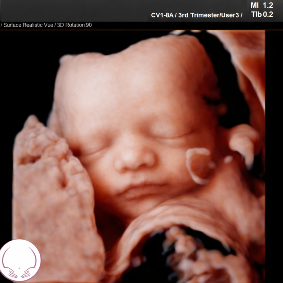 Photo shared by Destiny for their Babylist baby registry.