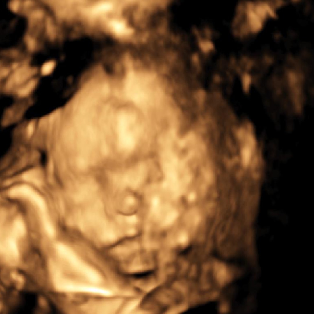 Photo shared by Marilyn for their Babylist baby registry.